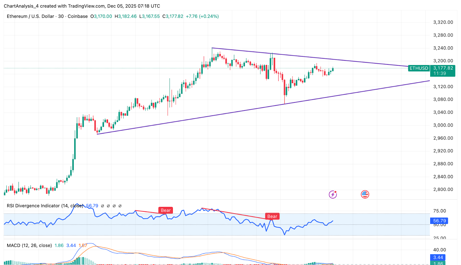 ETH Intraday Analysis