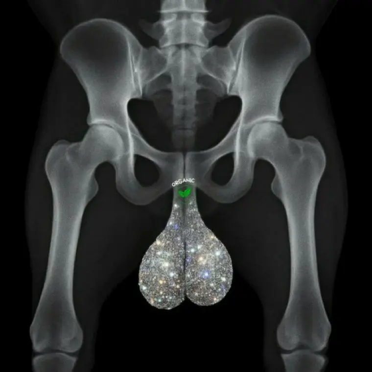 post-image