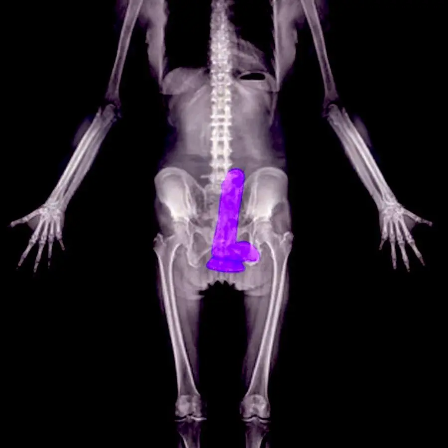 post-image