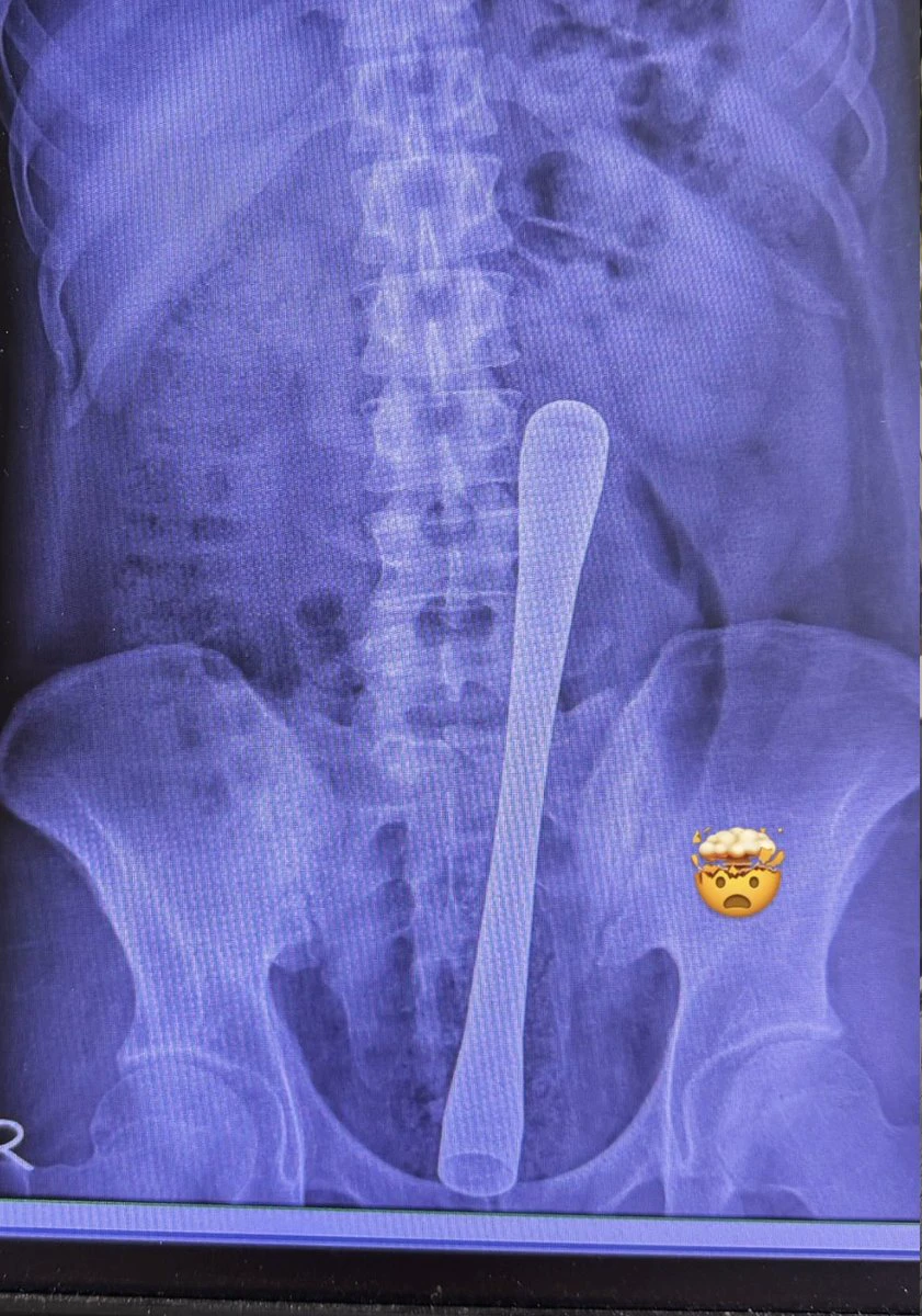 post-image