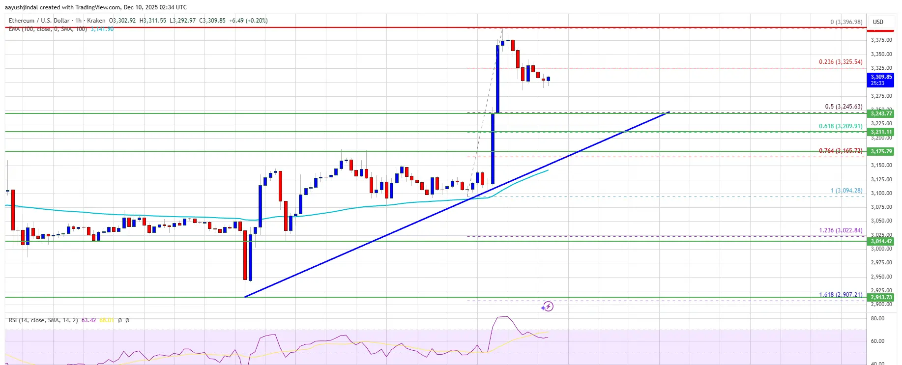 ETHテクニカル分析