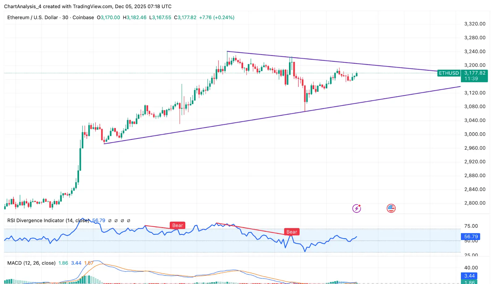 ETH Intraday Analysis