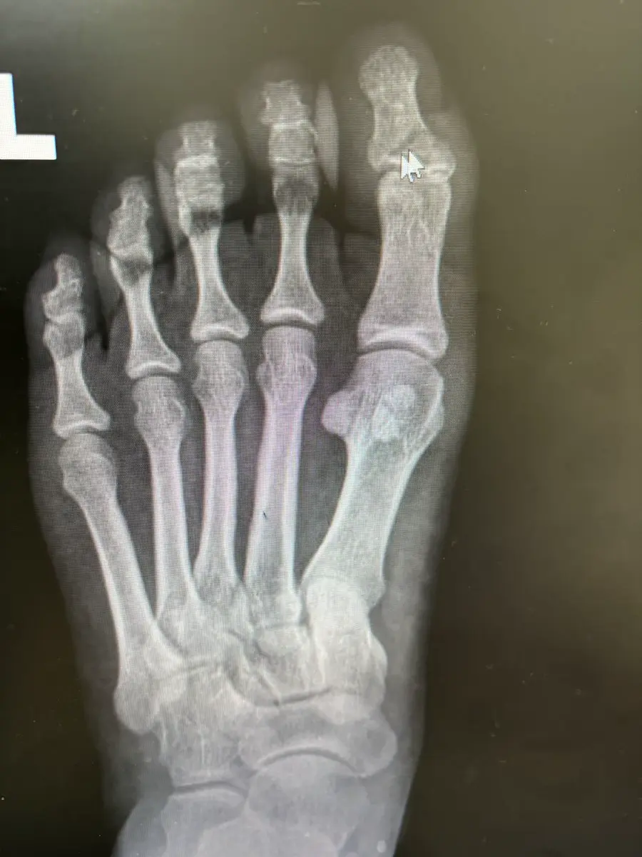 post-image
