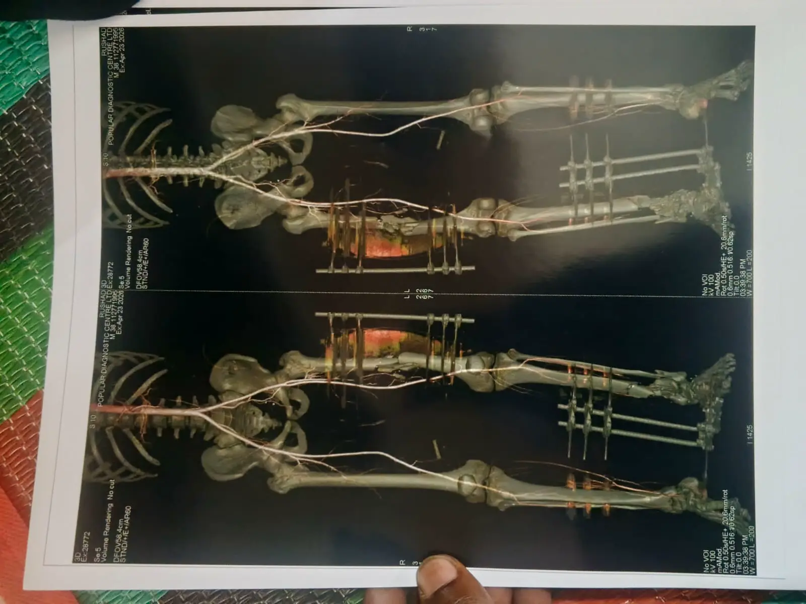 post-image