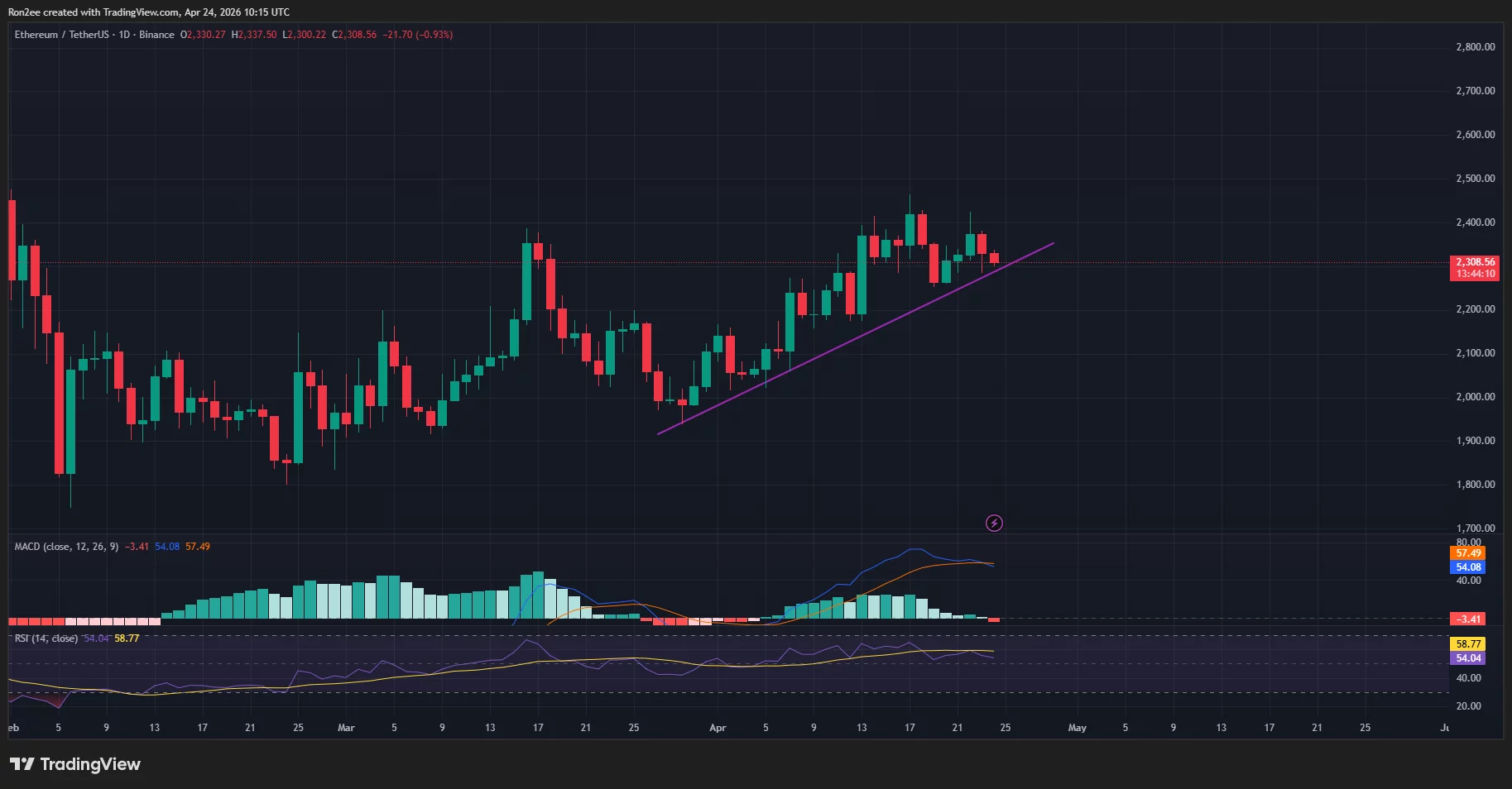 Ethereum price is testing an ascending trendline support on the daily chart.