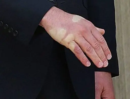 post-image