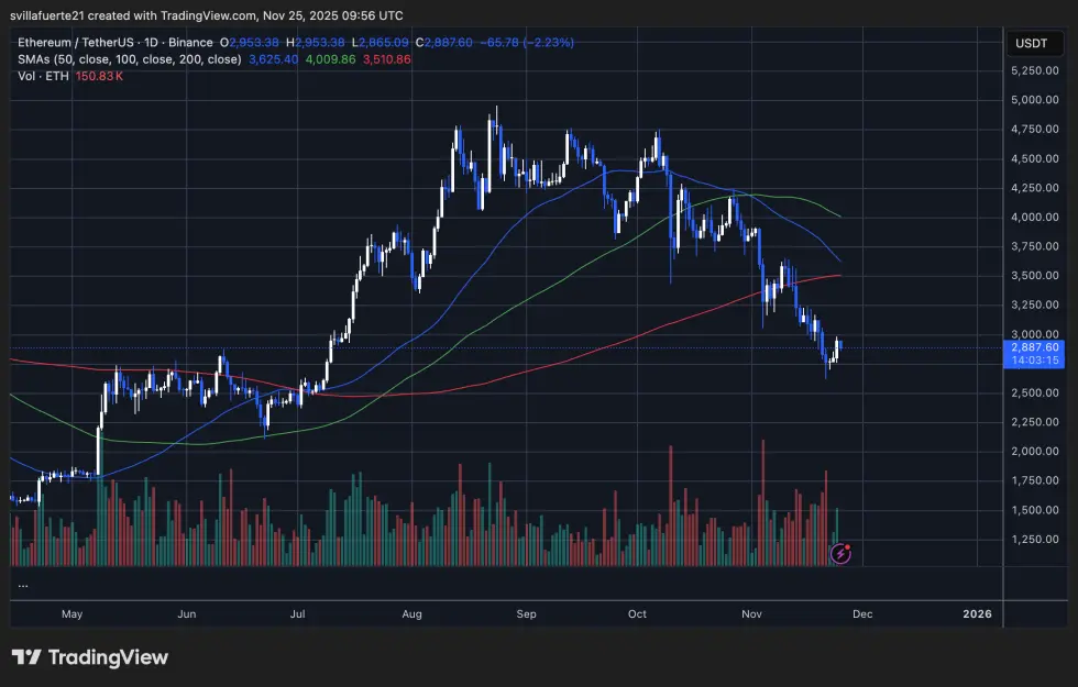 ETH yüksek fiyatları geri kazanmakta zorluk çekiyor | Kaynak: TradingViewdeki ETHUSDT grafiği